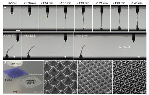  Melt-Electrowriting van Magnesium: Een Toekomstbestendige Oplossing voor Bioresorbable Implanten?